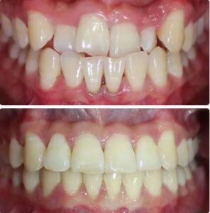 Orthodontics1