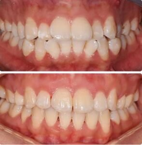 Orthodontics2
