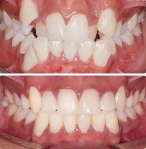 Orthodontics3