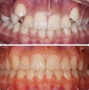 Orthodontics4