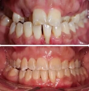 Orthodontics5