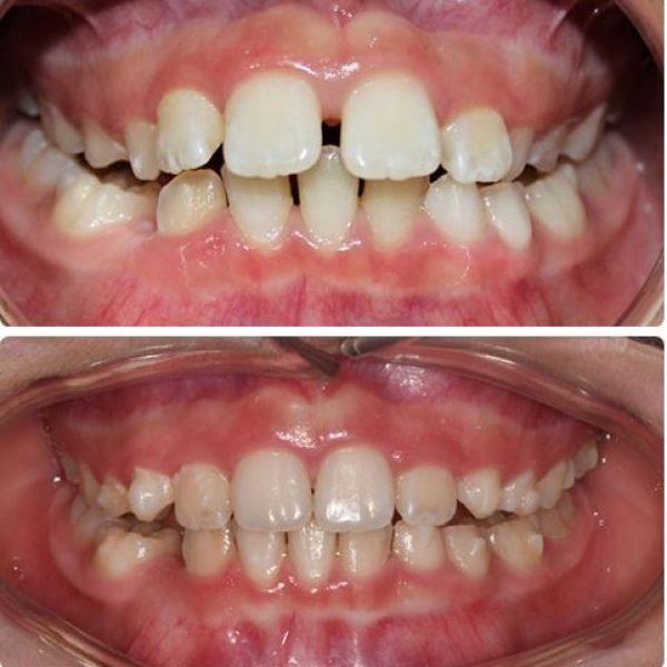 before&after